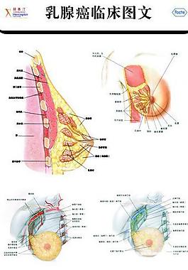 乳房癌臨床圖圖片