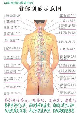 背部刮痧示意图图片