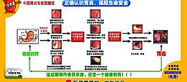 認識胃炎圖片