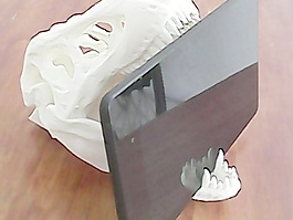 trexstand