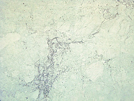 marble_background