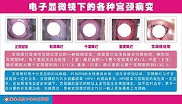 电子显微镜下的各种宫颈病变