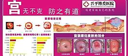 妇科 展板图片