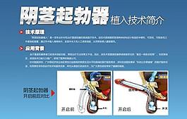 陰莖起勃器圖片
