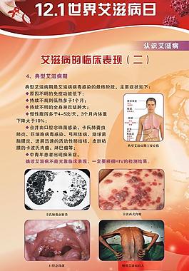 艾滋病海報圖片