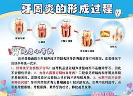 洗牙 牙科展板圖片