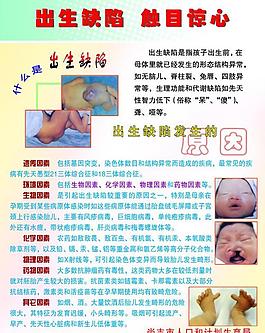 什么是出生缺陷展板圖片