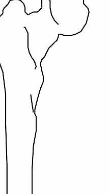 人體骨骼