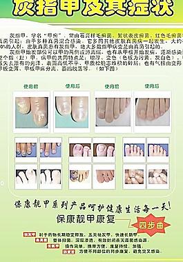 灰指甲及手足癬圖片