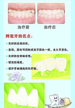 牙科KT板 3图片