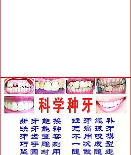 种牙图片