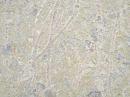 tree_skin_background