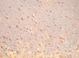 old_rusty_texture