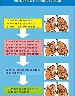 結核病 醫院宣傳圖片