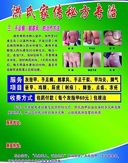 灰指甲 宣傳單