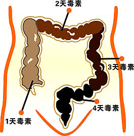 人體腸道毒素堆積