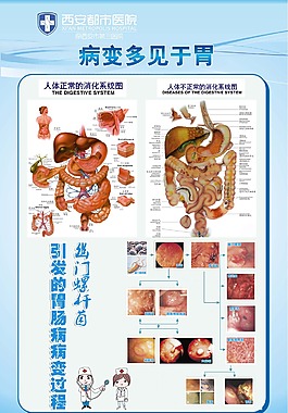 胃腸科消化系統掛圖