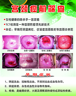 宫颈癌前筛查