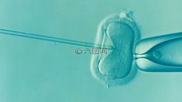 ivf,生育,不育