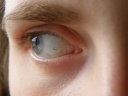 眼,蓝色,虹膜