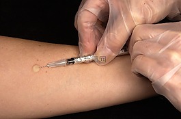接種疫苗,結(jié)核菌素試驗,注射器