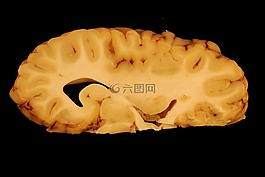 腦,解剖學,眼睛
