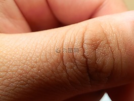 手指,皮膚,手