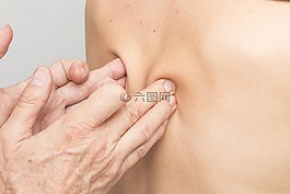 按摩,返回,治療