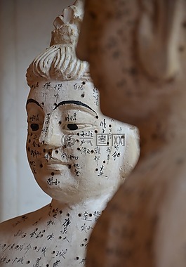 針灸,中醫,治療
