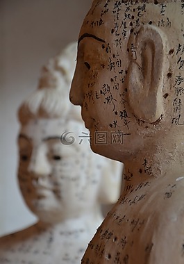 針灸,中醫,治療