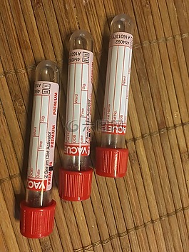 管,下载,血