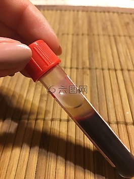 血,管,實(shí)驗(yàn)室