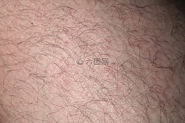 皮膚,頭發,腿部