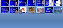 急腹癥的診斷與鑒別診斷