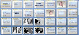 原發性縱隔腫瘤(課件)