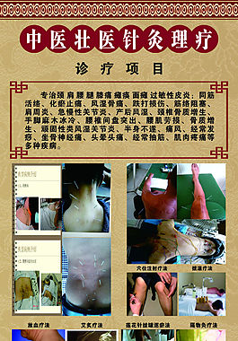 中醫壯醫針灸理療