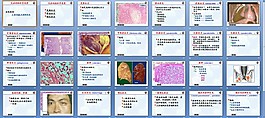 炎症的类型