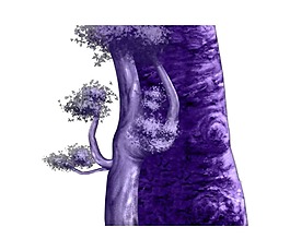 藍色樹樁png元素