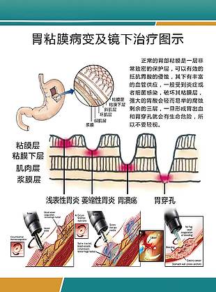 胃粘膜