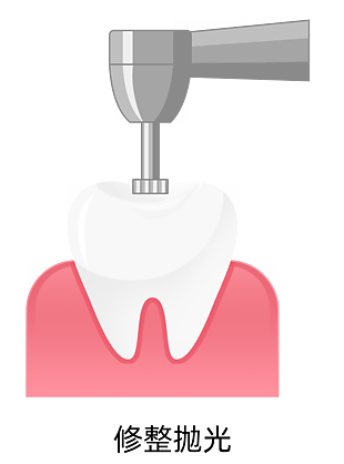補牙流程