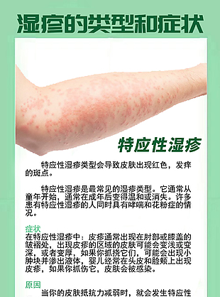 特應(yīng)性濕疹醫(yī)療衛(wèi)生展板設(shè)計(jì)