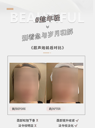 美容效果对比海报
