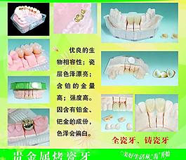 贵金属烤瓷牙展板图片