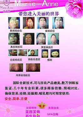玛丽艳祛斑用品图片