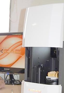 modelos ortodonticos digitais EM 3D