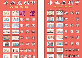 灰指甲室内装饰图片