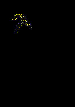 男孩