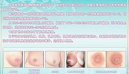 乳腺疾病