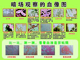 暗场观察的血像图
