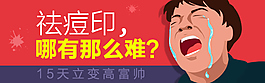 祛痘印